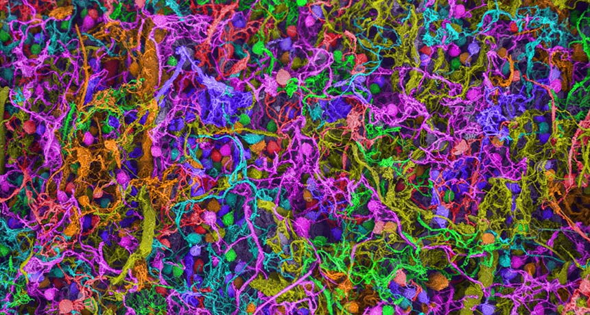 a colorful scanning electron micrograph showing a close-up of brain nerve cells