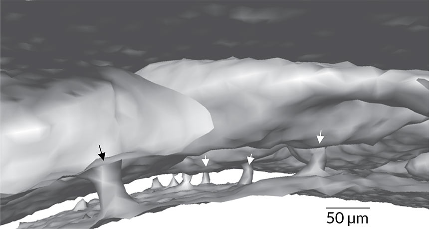 skull channels