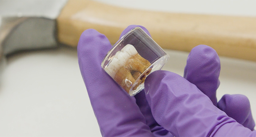 Neandertal teeth
