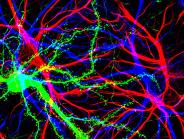dendritic spines on nerve cells