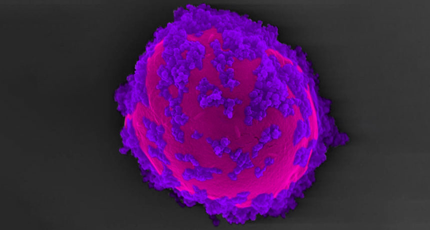 yeast cell