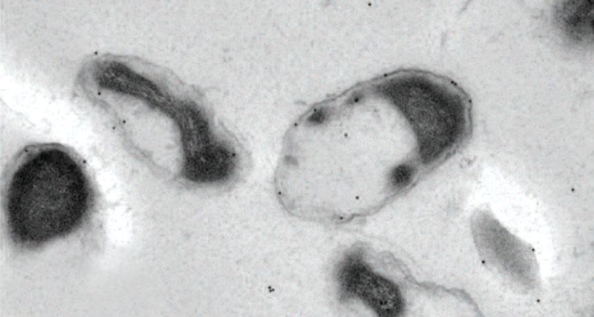 gut bacterium