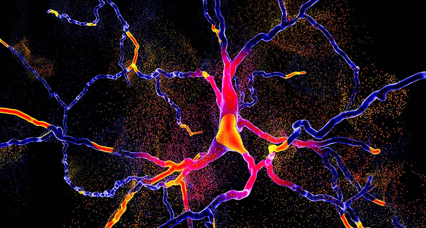 brain cells