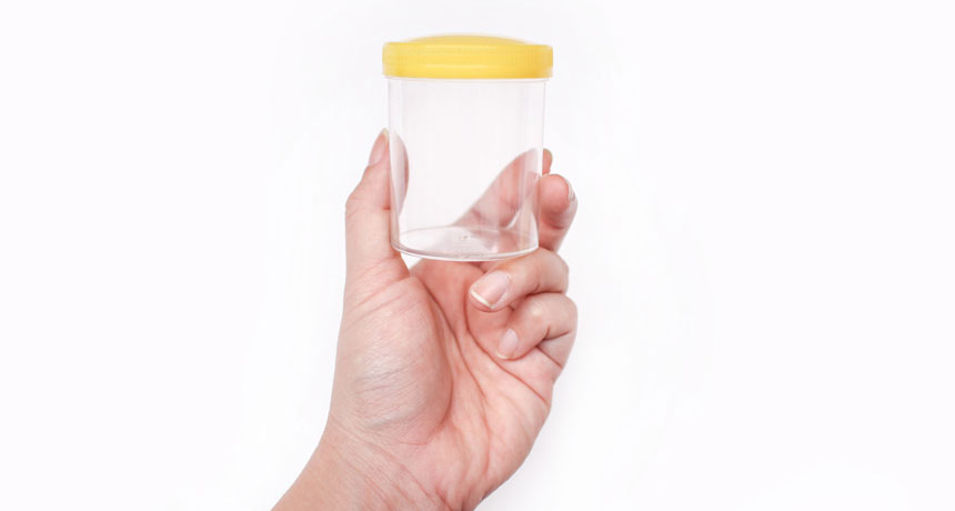 hand holding poop sample cup