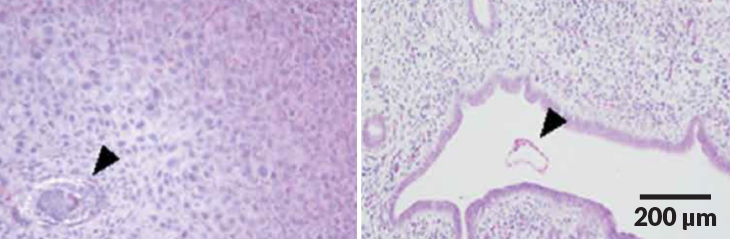 differences in embryo attachment to uterine lining