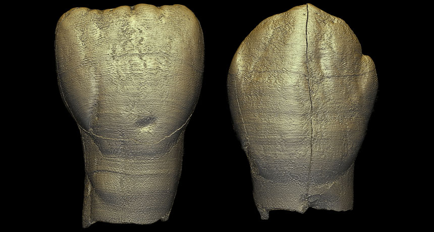 digital reconstruction of two teeth