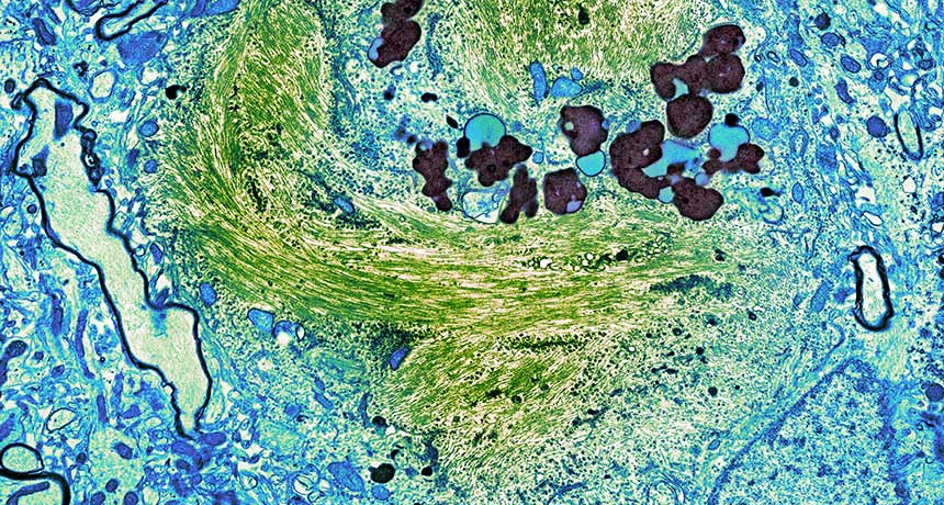 tau neurons