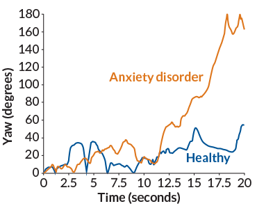 a graph showing how children with an anxiety disorder reacted differently to a percieved threat