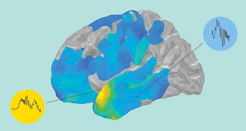 brain ripples