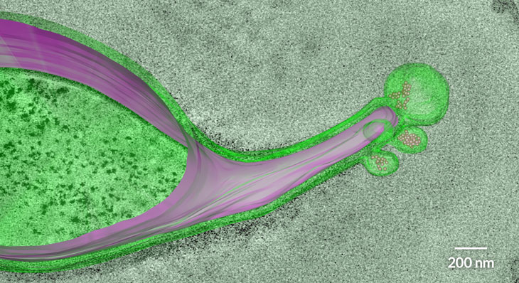 vesicles