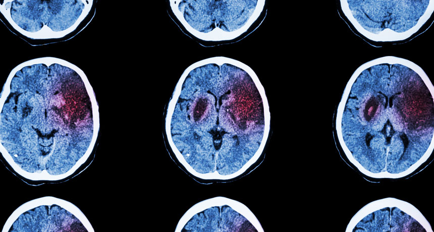 brain scans