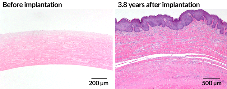 blood vessel tissue
