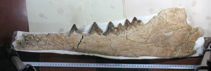 mandible bone