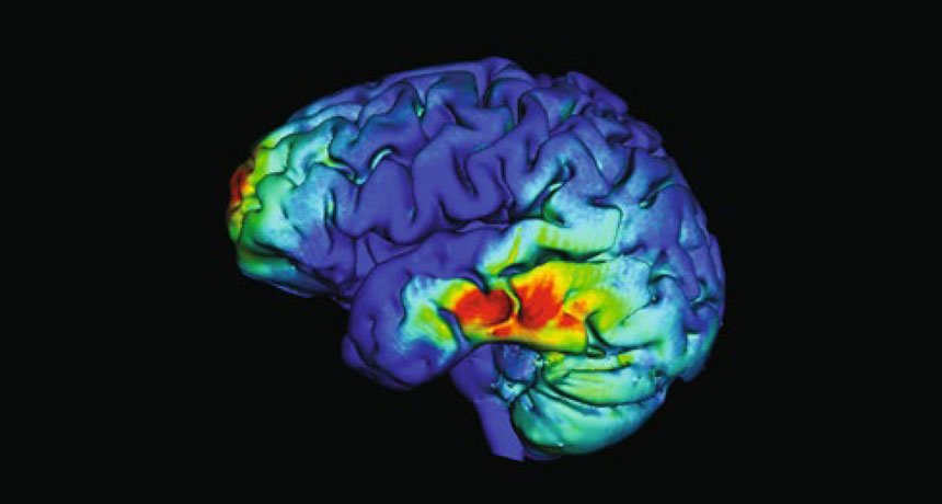 brain scan