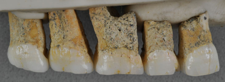 fossil teeth