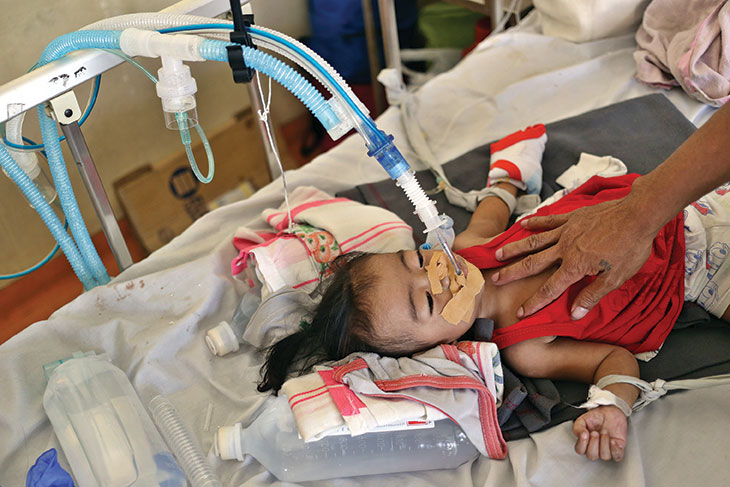 child on respirator