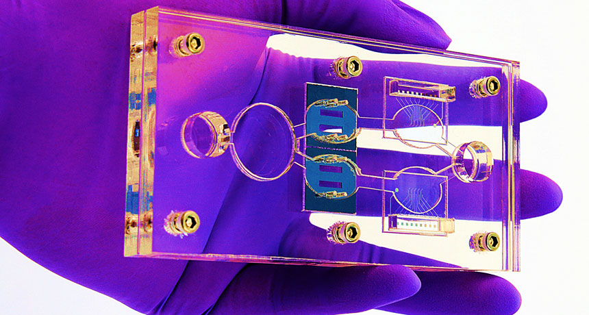 body-on-a-chip
