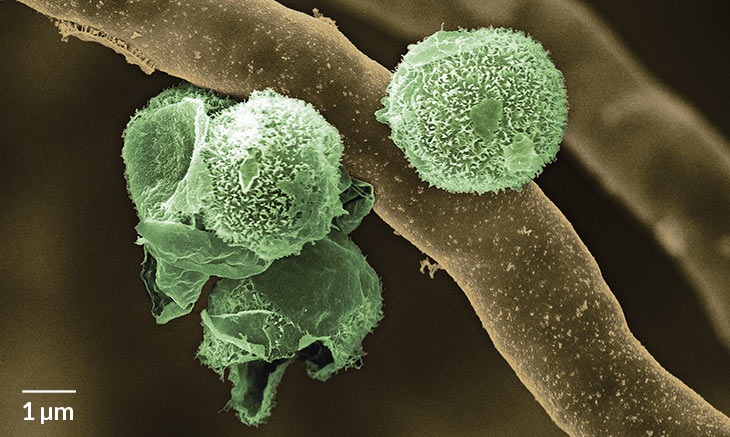 algal and fungal cells
