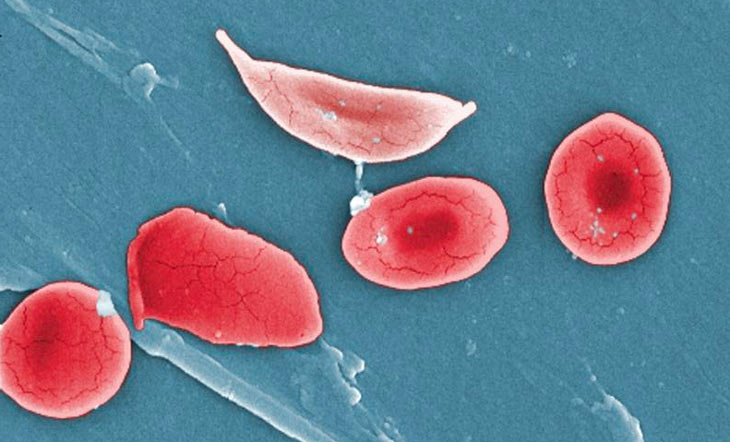 red blood cells