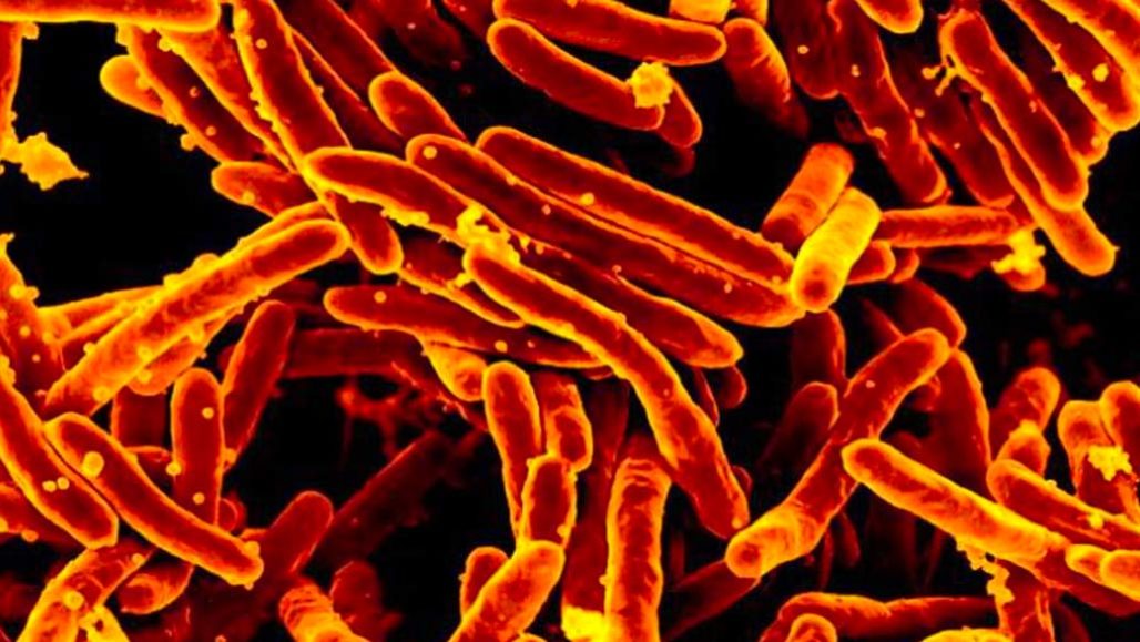 a photo of Mycobacterium tuberculosis