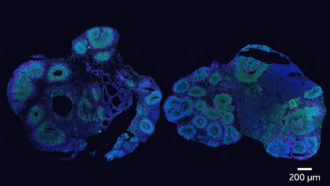 Cerebral organoids made of human cells (left) or chimpanzee cells (right)