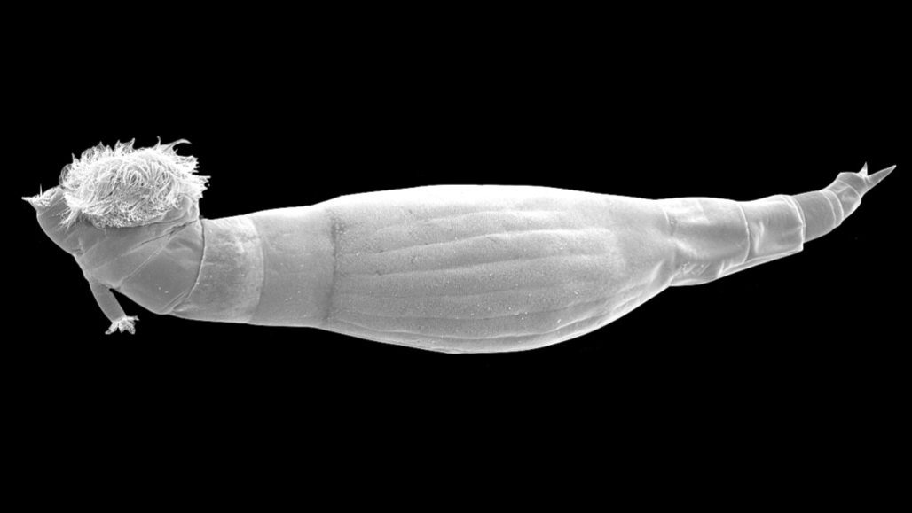 Rotifers secrete a compound that may help combat schistosomiasis | Science News Rotifers secrete a compound that may help combat schistosomiasis | Science News