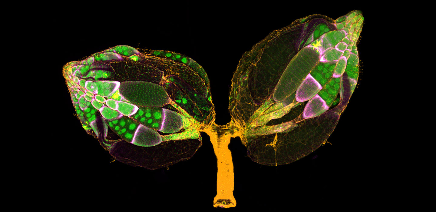 fruit fly ovaries