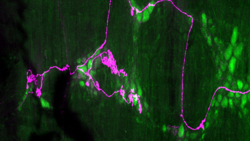 mouse intestine