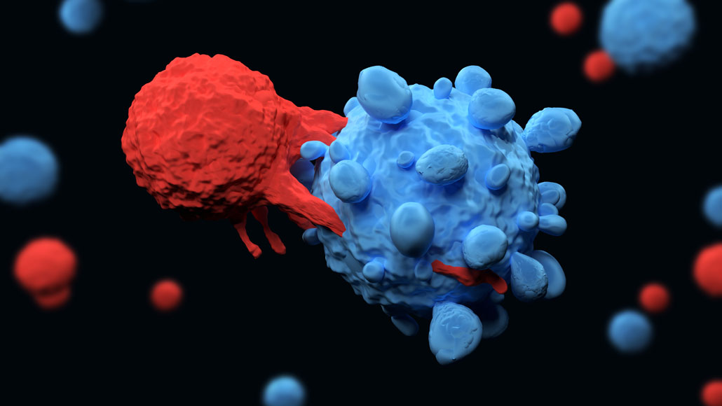 Exploding cancer cells can cause side effects in CART cell therapies