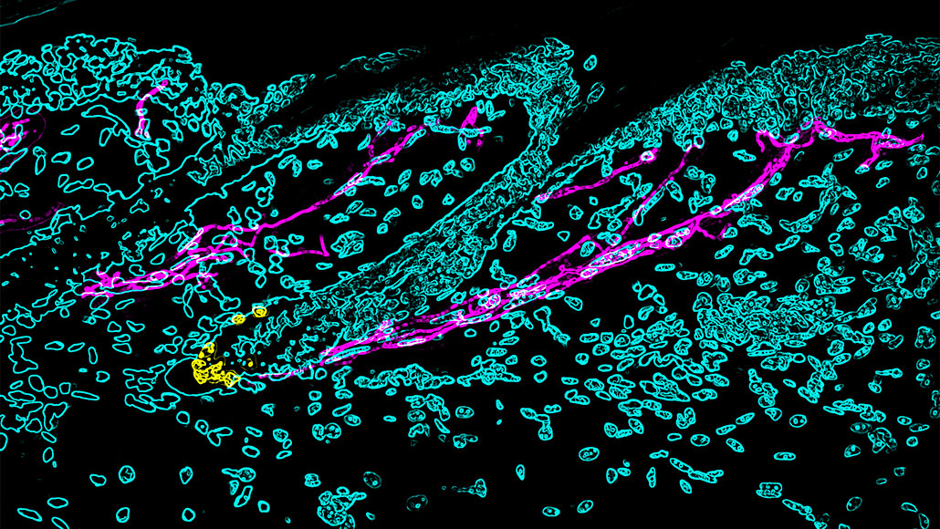 How Stress Turns Hair Gray Science News