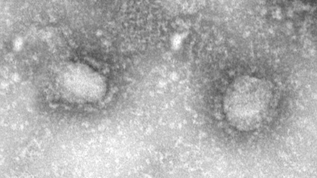 How The New Coronavirus Stacks Up Against Sars And Mers Science News