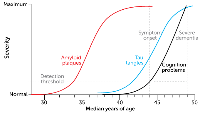 Early onset Alzheimer’s progression