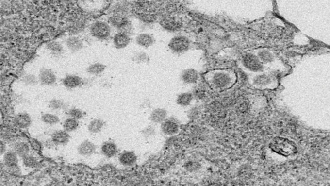 coronavirus electron micrograph