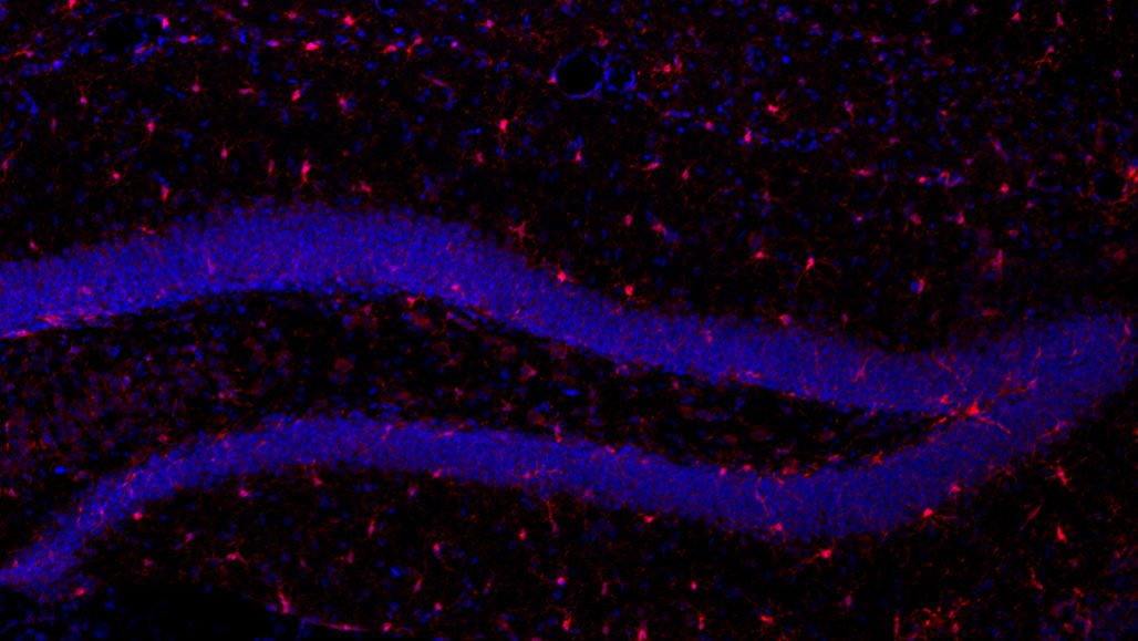 microglia and nerve cells