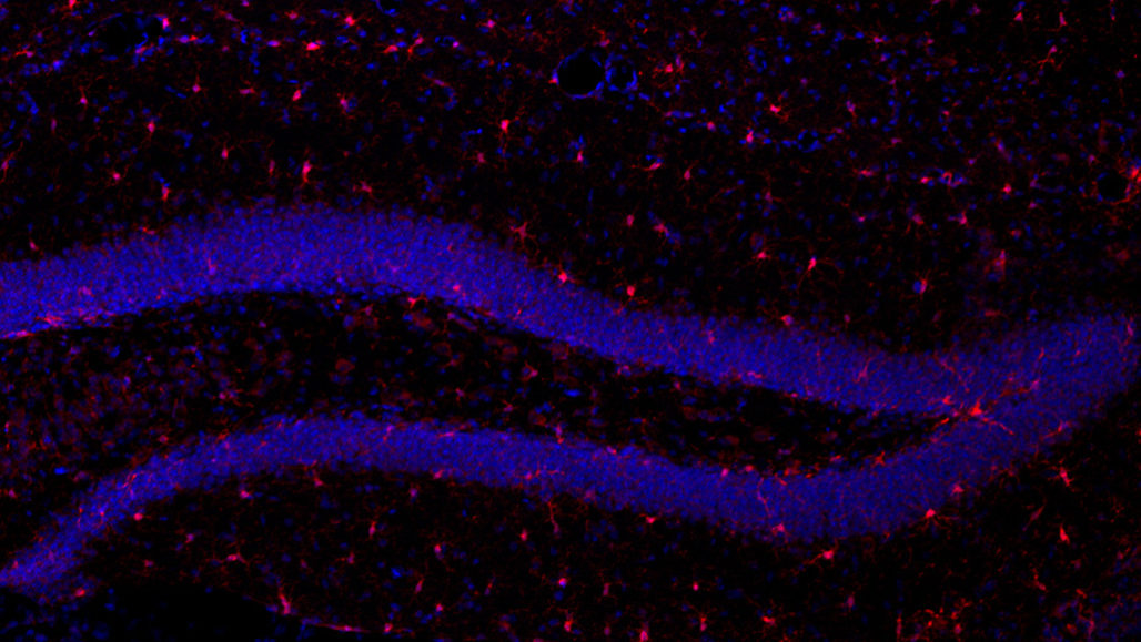microglia and nerve cells