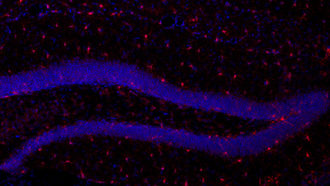 microglia and nerve cells