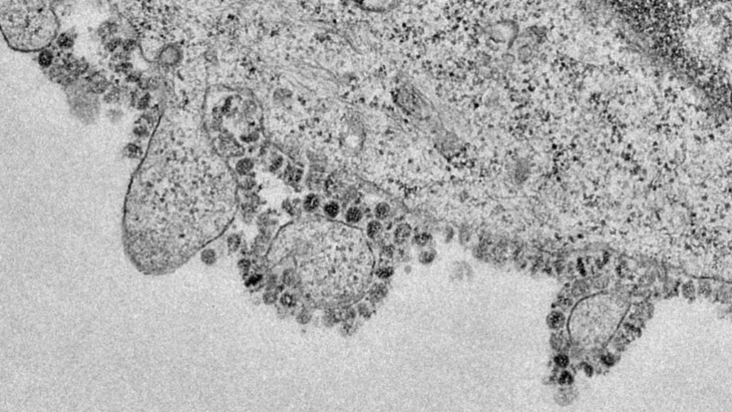 electron micrograph of the new coronavirus, nCov-2019