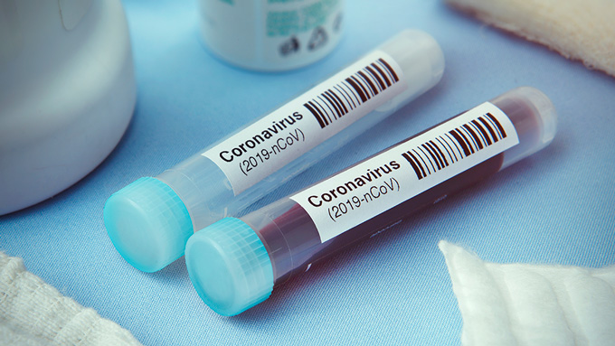 coronavirus test samples