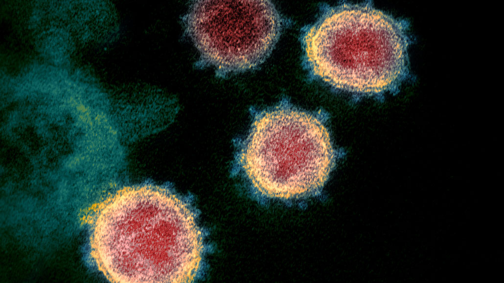 No, the coronavirus wasn't made in a lab, a genetic analysis shows ...
