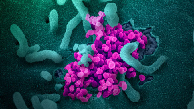 Coronavirus electron micrograph image