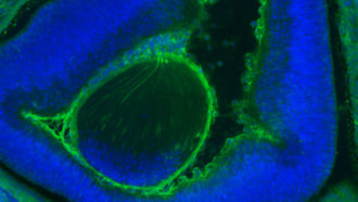 false-color microscope image of embryonic mouse eye