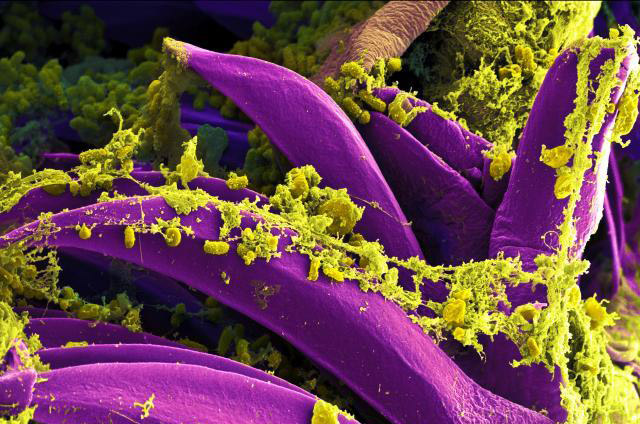 Yersinia pestis bacteria