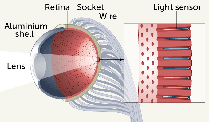 artificial eyeball diagram