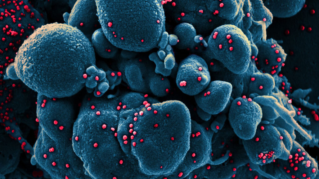 coronavirus,