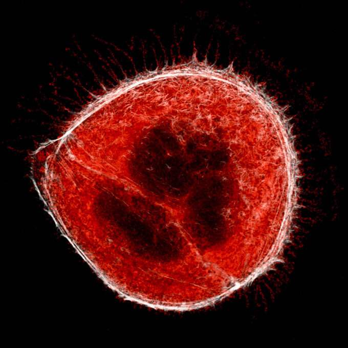 SARS-CoV-2-infected cell with filopodia