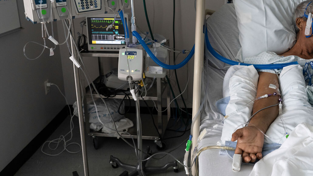 A blood test may show which COVID19 patients steroids will help