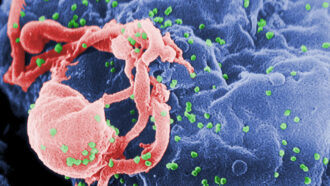 false-color microscope image of HIV on a human cell