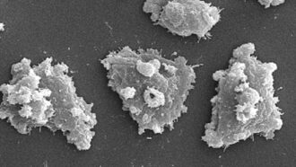 a microscopic image of Naegleria fowleri