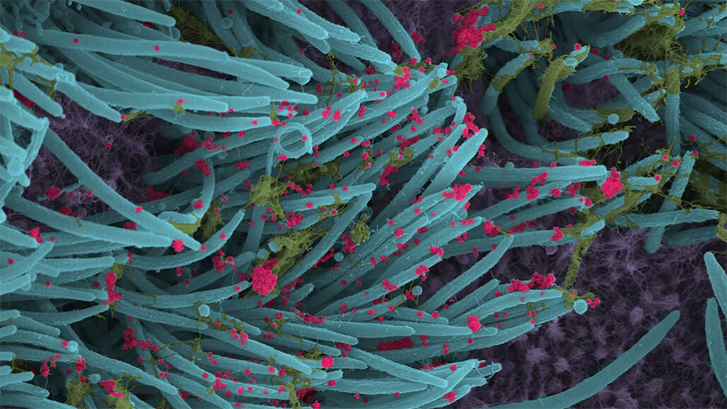 false-color microscope image of small virus particles on a lung cell