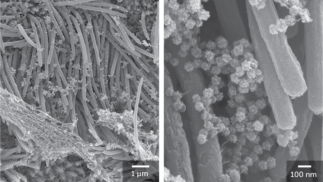 immagini al microscopio in bianco e nero di particelle rotonde di coronavirus che ricoprono le ciglia simili a capelli di una cellula polmonare